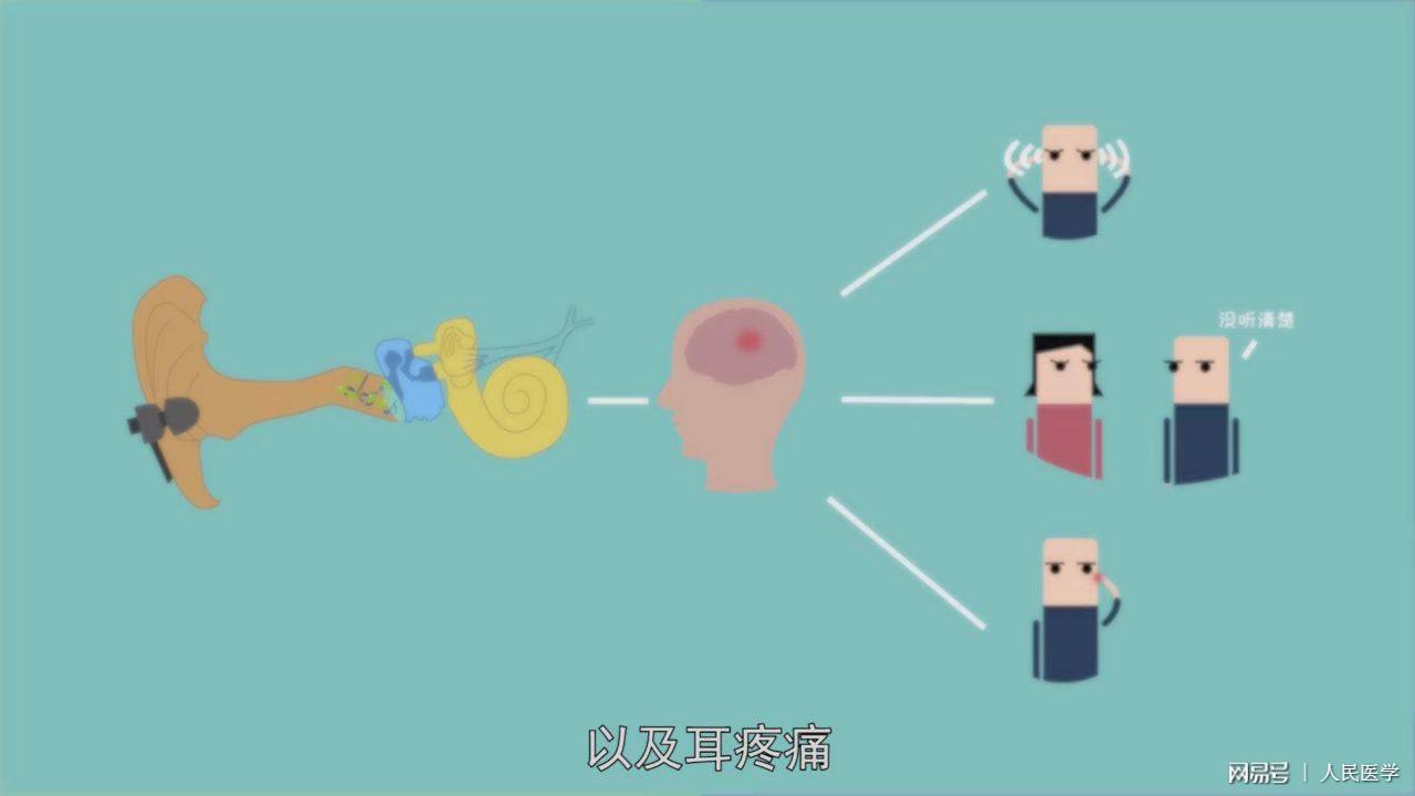 国际治疗耳鸣最新动态,国际治疗耳鸣最新动态